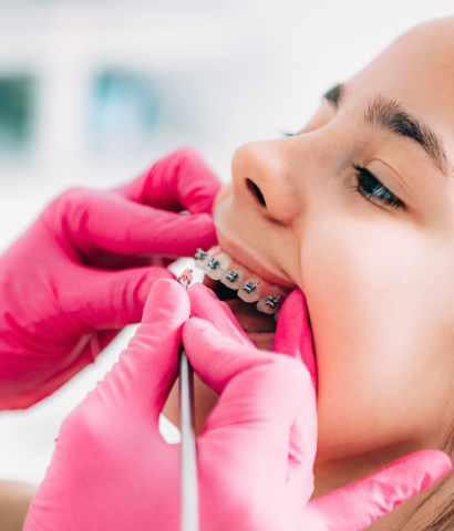 Orthodontist-Working-on-Girl's-Braces